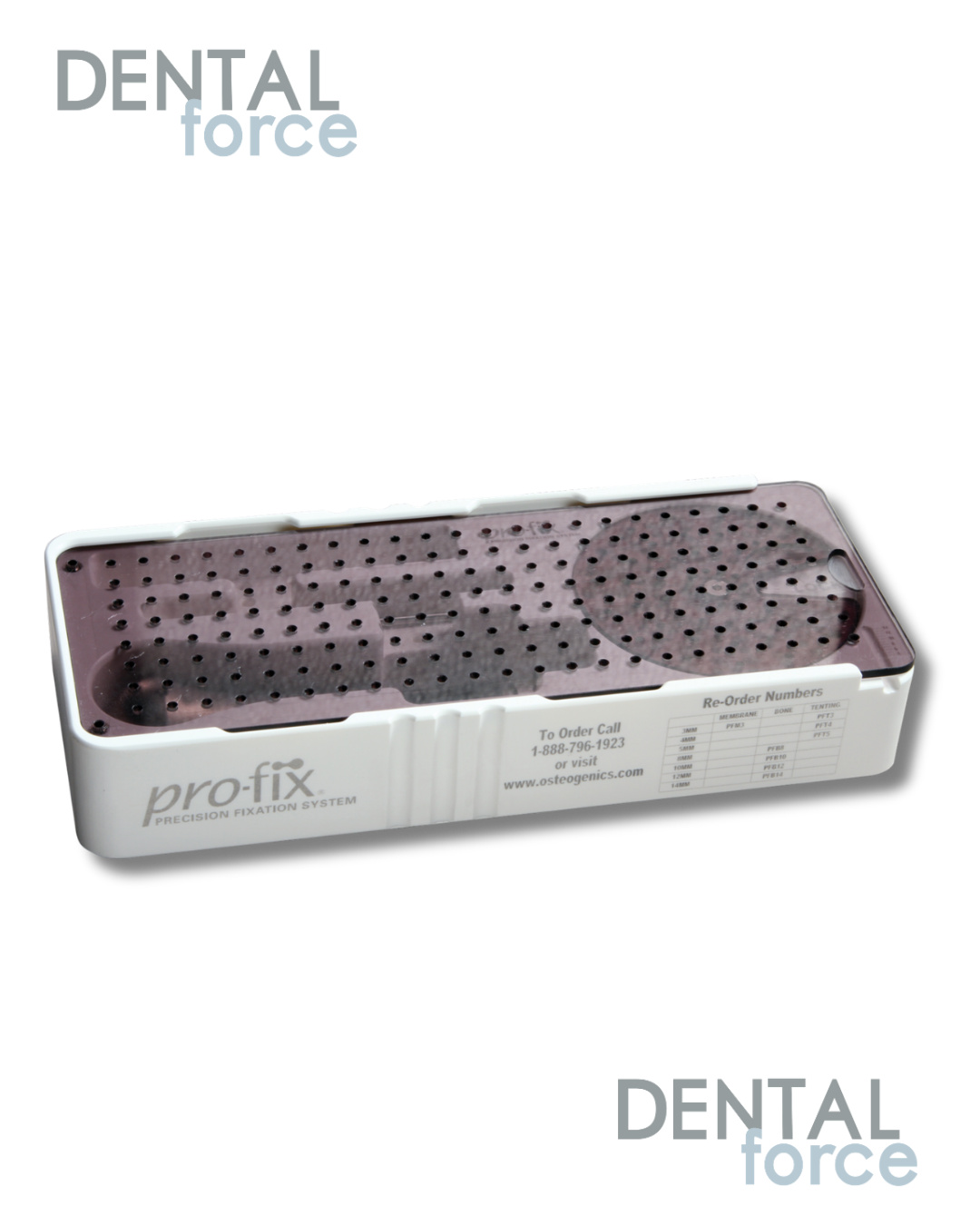 Pro-fix™ - Kit de Fixation